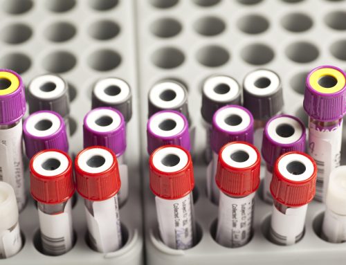 Why Bloodwork is the Cat’s Meow for Pet Health
